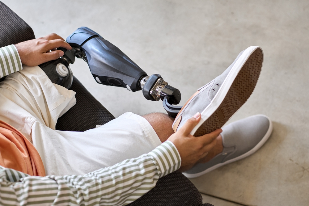 Man with an above-knee prosthetic leg sitting on a sofa