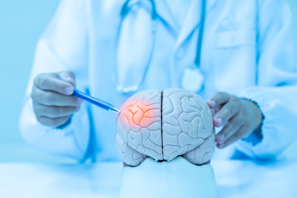 Neurologist hand pointing brain anatomy human model and brain disease lesion on white background